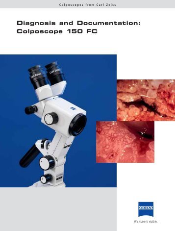 Diagnosis and Documentation: Colposcope 150 FC - Carl Zeiss, Inc.