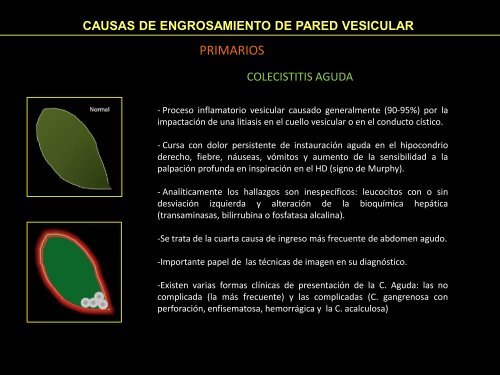 causas de engrosamiento de pared vesicular