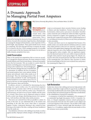 A Dynamic Approach to Managing Partial Foot Amputees - Camp ...