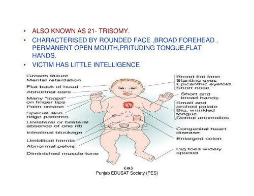 GENETIC DISORDERS & STRUCTURE OF DNA,