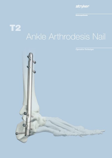 Acute retrograde tibiotalocalcaneal nailing in osteoporotic periarticular  ankle fractures