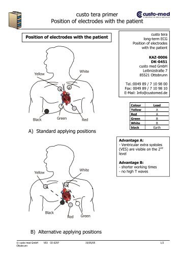 custo tera primer Position of electrodes with the patient - custo.med