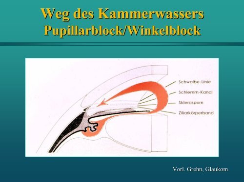 Weg des Kammerwassers - Augenklinik