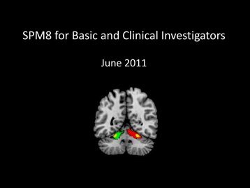 SPM Overview - Neurometrika
