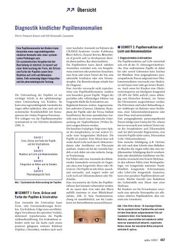 Diagnostik kindlicher Pupillenanomalien - ophta