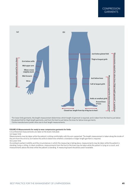 best practice for the management of lymphoedema ... - EWMA