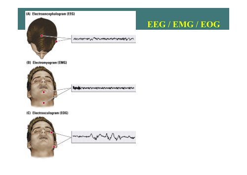 Physiology of Sleep