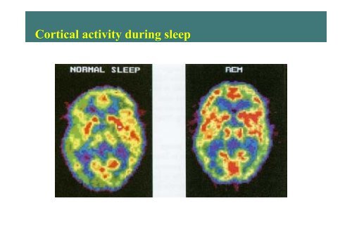 Physiology of Sleep