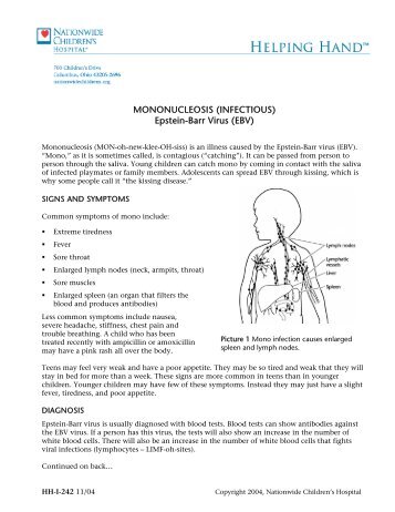 MONONUCLEOSIS (INFECTIOUS) Epstein-Barr Virus (EBV)