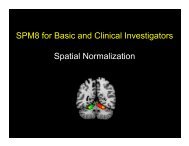 Clinical fMRI LEC16 Spatial Normalization - Neurometrika