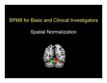 Clinical fMRI LEC16 Spatial Normalization - Neurometrika