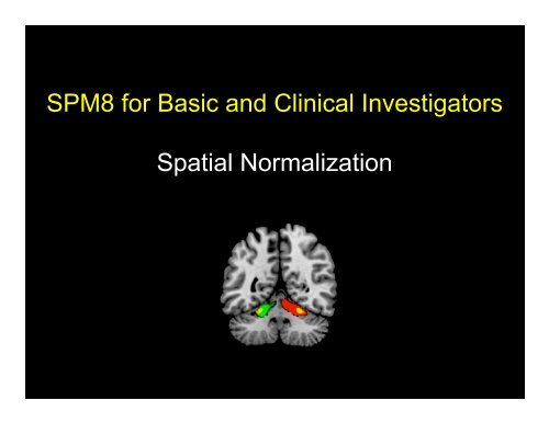 Clinical fMRI LEC16 Spatial Normalization - Neurometrika