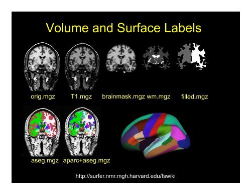 SPM Anatomy Toolbox