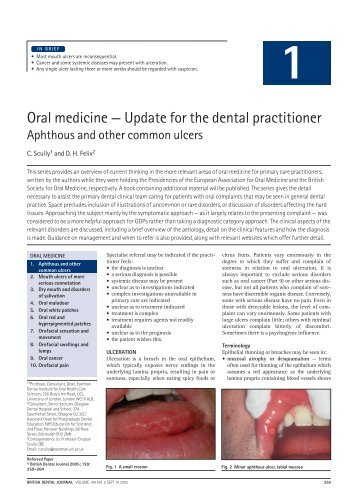 Oral medicine â Update for the dental practitioner - Oral Cancer ...