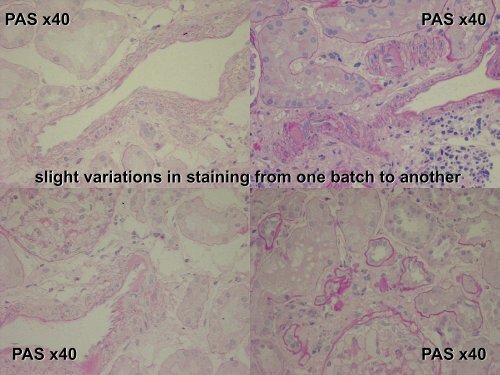 PAS x40 - RCPA