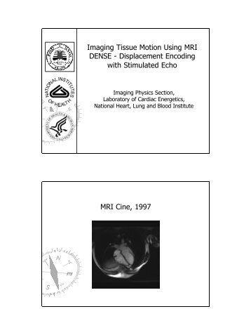 Imaging Tissue Motion Using MRI DENSE - Displacement Encoding ...