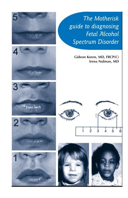 Sample Pages: The Motherisk Guide To Diagnosing FASD