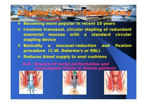 Management of Rectal Prolapse, and Common Anorectal Conditions