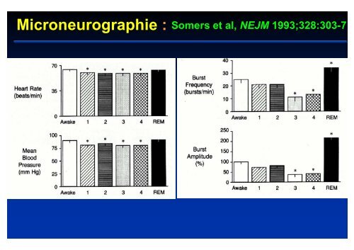 SNA et rÃ©gulation cardio-vasculaire au cours du sommeil - SPLF