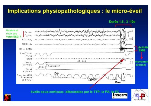 SNA et rÃ©gulation cardio-vasculaire au cours du sommeil - SPLF