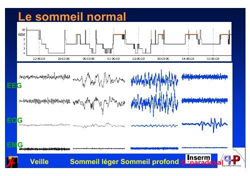 SNA et rÃ©gulation cardio-vasculaire au cours du sommeil - SPLF