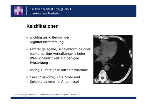 Der kleine Lungenrundherd: Wie gehe ich damit um?