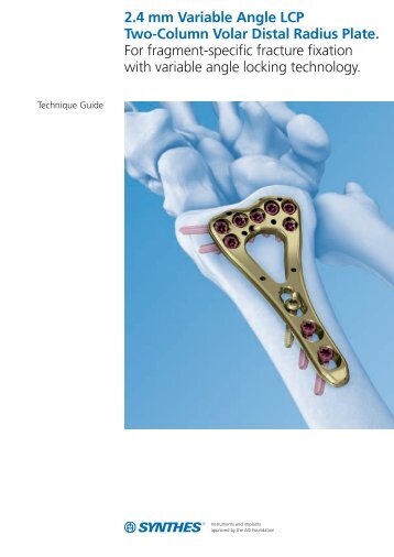 2.4 mm Variable Angle LCP Two-Column Volar Distal Radius Plate ...