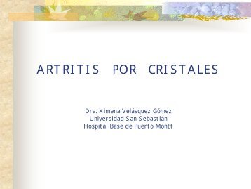 ARTRITIS POR CRISTALES