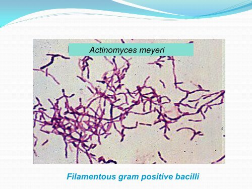 anaerobic bacteria