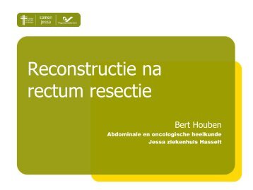 Reconstructie na rectum resectie - Stomavlas