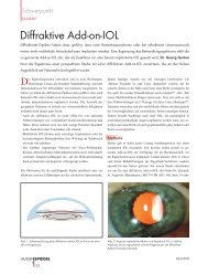 Diffraktive Add-on-IOL