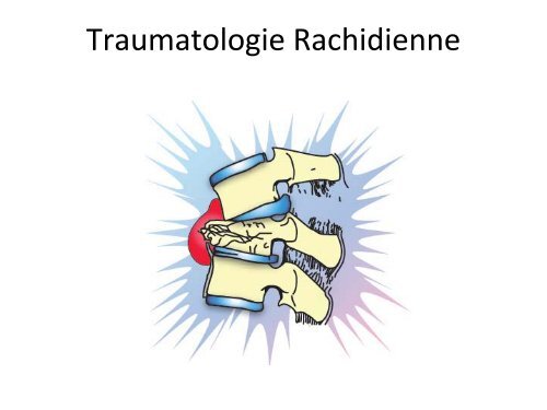 Fractures du membre infÃ©rieur et du rachis - R VIALLE - SOFOP