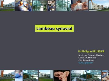 Lambeau synovial - e-plastic.fr