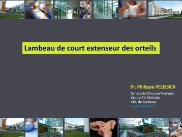 Lambeau de court extenseur des orteils - e-plastic.fr