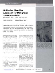 Utilitarian Shoulder Approach for Malignant Tumor ... - Tumor Surgery