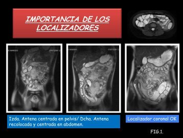 TECNICA DE ESTUDIO