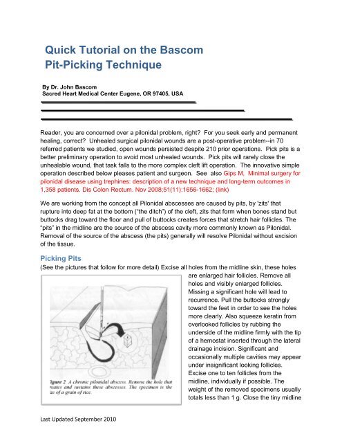 Quick Tutorial on the Bascom Pit-Picking ... - Pilonidal Disease