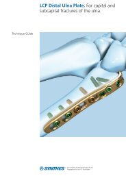 LCP Distal Ulna Plate. For capital and subcapital fractures of the ulna.