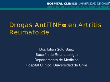 Tratamiento con Anti-TNF en Artritis Reumatoide