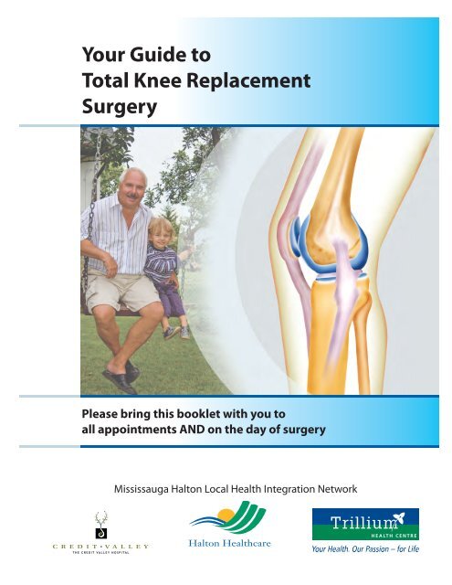 https://img.yumpu.com/45818973/1/500x640/your-guide-to-total-knee-replacement-surgery-trillium-health-.jpg