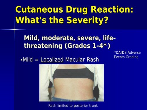 Approach to Rash in a Patient with HIV