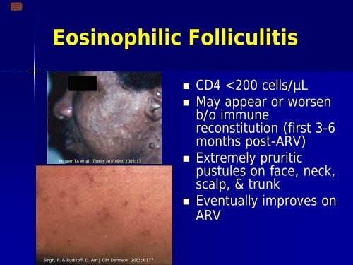 Approach to Rash in a Patient with HIV