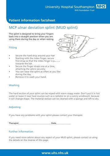 MCP ulnar deviation splint (MUD splint)