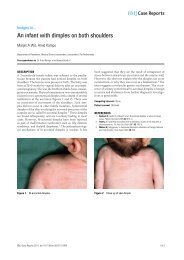 An infant with dimples on both shoulders - BMJ Case Reports