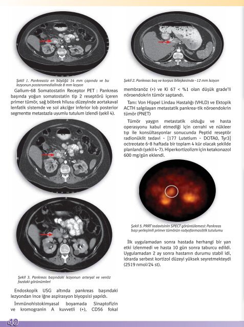 2013 Endokrin Vakalar KitabÄ± - TÃ¼rkiye Endokrinoloji Metabolizma ...