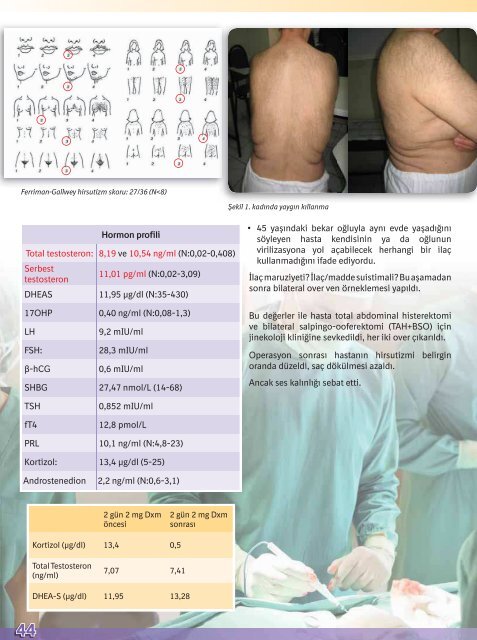 2013 Endokrin Vakalar KitabÄ± - TÃ¼rkiye Endokrinoloji Metabolizma ...