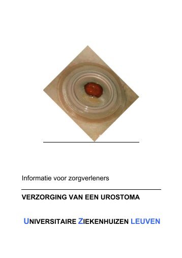 handleiding stomazorg in de UZ Leuven VERZORGING
