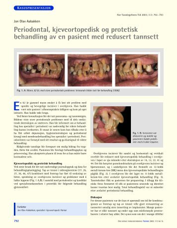 Periodontal, kjeveortopedisk og protetisk behandling av en pasient ...