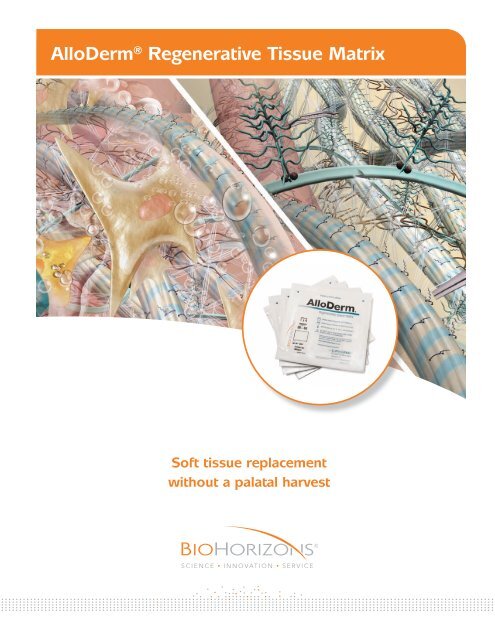 AlloDermÂ® Regenerative Tissue Matrix - BioHorizons