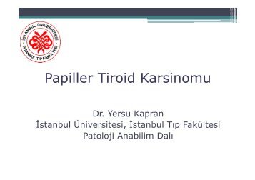 Papiller Tiroid Karsinomu